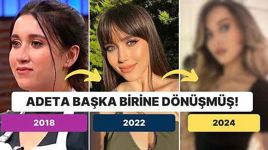 Estetikle Başka Birine Dönüşmüş: Eski MasterChef Yarışmacısı Eslem Sena Yurt Değişimiyle Herkesi Şaşırttı!