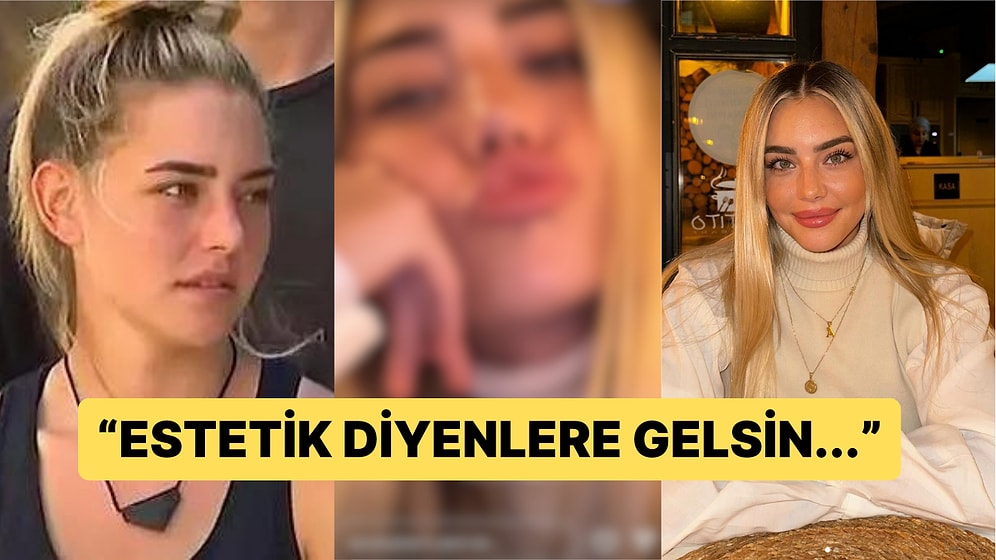 Survivor ile Hatırladığımız Aycan Yanaç Estetik İddialarına Okkalı Bir Cevap Verdi