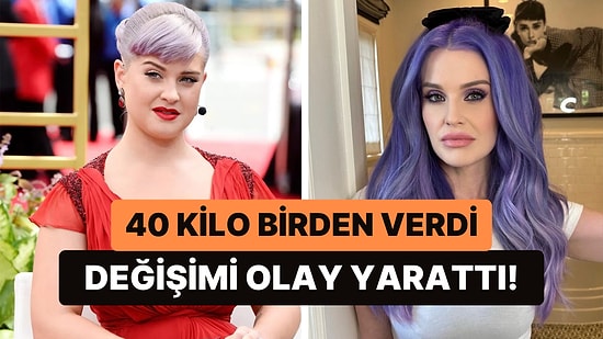 Resmen Yüz Nakli Geçiren Kelly Osbourne "Hiç Estetiğim Yok" Açıklaması Yapınca Göz Sağlımızdan Şüphe Ettirdi