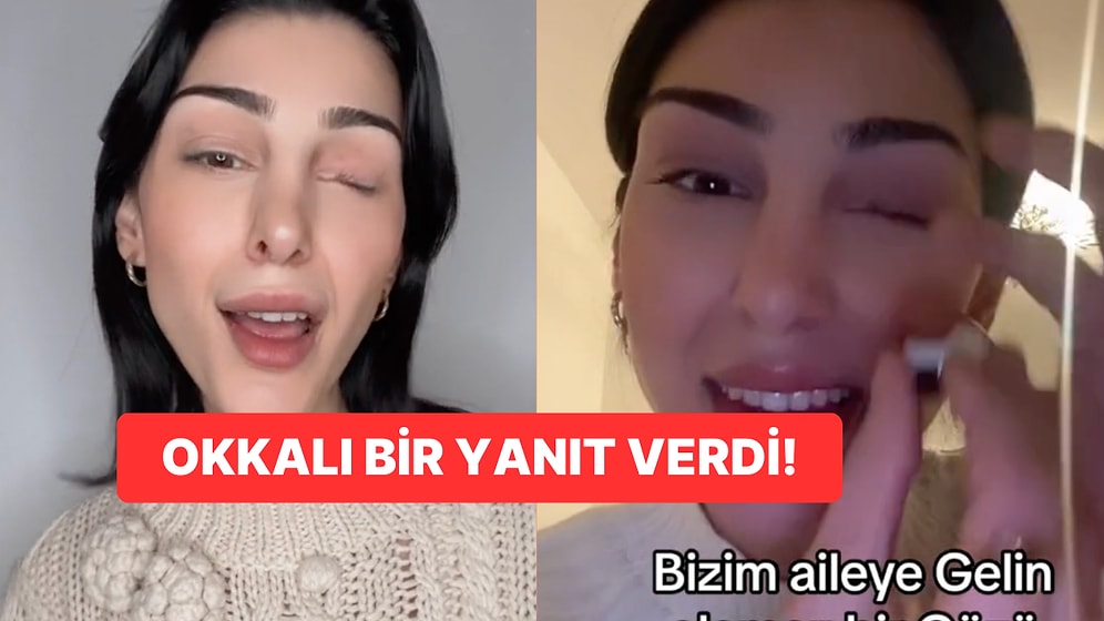 Bir Gözü Olmayan TikTok Kullanıcısı Kadına Yapılan Zorbalık Dolu Yorum!