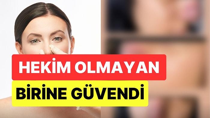 İzmir'de Bir Kişi Güzellik Salonunda Hekim Olmayan Birisine Yaptırdığı Dolgu Sonucunda Burnunu Kaybetti