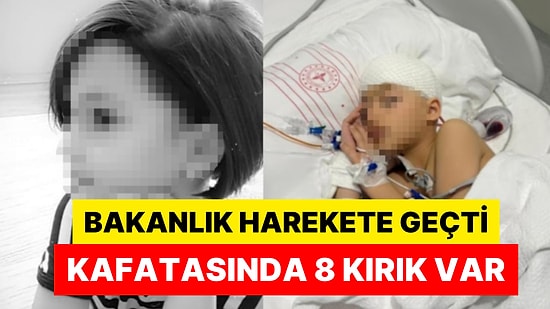 Okulda Düştü İddiası: 8 Yaşındaki Çocuk Beyin Kanaması Geçirdi, Kafatasında 8 Kırık Var