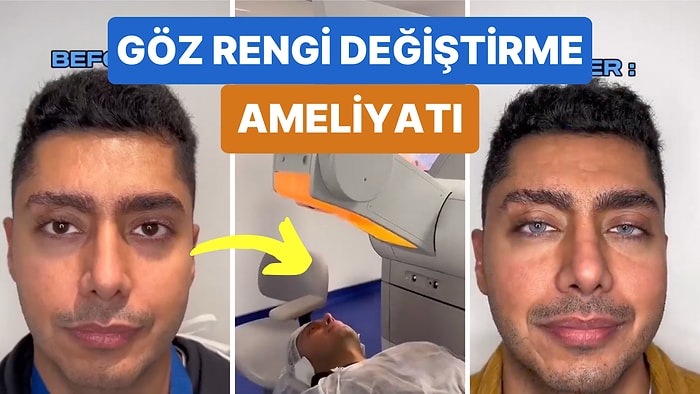 Tıp Dünyasının Geldiği Son Nokta: Bir Adam Ameliyatla Kahverengi Gözlerini Maviye Çevirtti