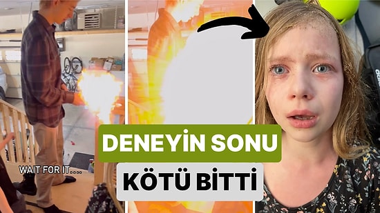 Bir Genç Pet Şişe ile Roket Yapma Deneyi Yaparken Kardeşinin Saçını ve Kaşlarını Yaktı