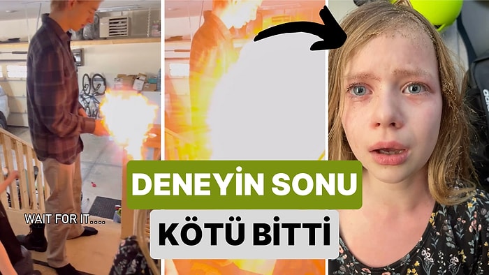 Bir Genç Pet Şişe ile Roket Yapma Deneyi Yaparken Kardeşinin Saçını ve Kaşlarını Yaktı