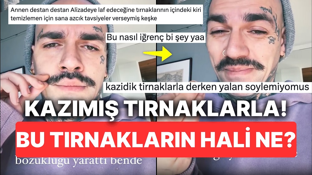 Ezhel'in Pislikten Görünmeyen Tırnak Dipleri İçinizi Kaldıracak