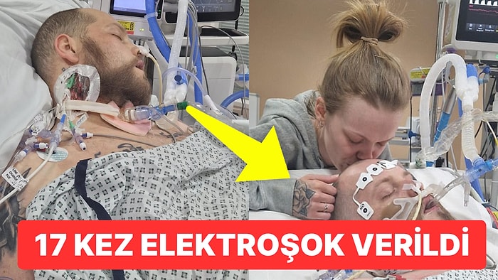 Elli Dakika Boyunca Kalbi Duran Talihsiz Adamın Doktorları Bile Şaşırtan Hayata Tutunma Hikayesi