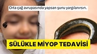 Sülük Kullanarak Göz Numarasını Küçülttüğünü İddia Eden Hacamatçı Tartışma Yarattı