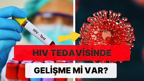 HIV Tedavisinde Kullanılacak Aşılarla İlgili Yeni Gelişme İddiası!