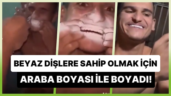 Araba Boyama Tabancası ile Dişlerini Boyayarak Beyazlatan Adam