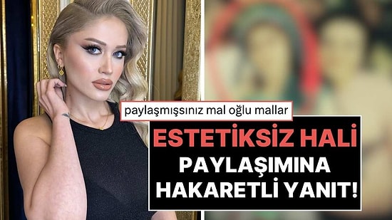 Muhtar Adaylığından Çekilen Model Simurg Sarsılmaz'dan 'Estetiksiz Hali' Paylaşımlarına Sert Tepki!