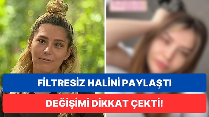 İsmail Balaban'la Evlenerek Şaşırtmıştı: Estetikleriyle Övünen Survivor İlayda Şeker'den Filtresiz Fotoğraf