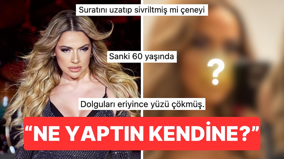 Hadise'den Jet Hızıyla Geri Vites: Fotoğrafını Paylaştı, "Yüzüne Ne Oldu?" Yorumları Yağınca Anında Sildi!