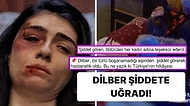 8 Mart Öncesi İnci Taneleri'nde Şiddete Uğrayan Dilber'e Kadınlardan Destek Yağdı!