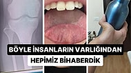 Birbirinden İlginç Genetik Özellikleriyle Akıllara Durgunluk Veren 20 Eşsiz Kişi