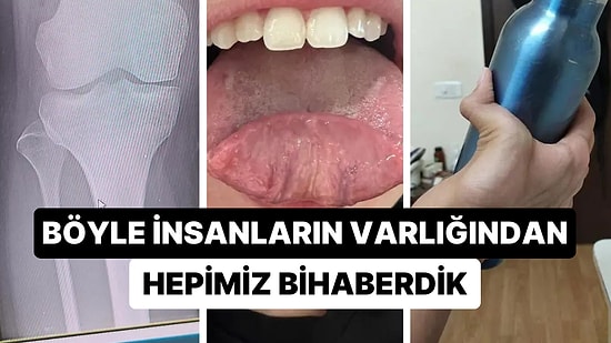 Birbirinden İlginç Genetik Özellikleriyle Akıllara Durgunluk Veren 20 Eşsiz Kişi