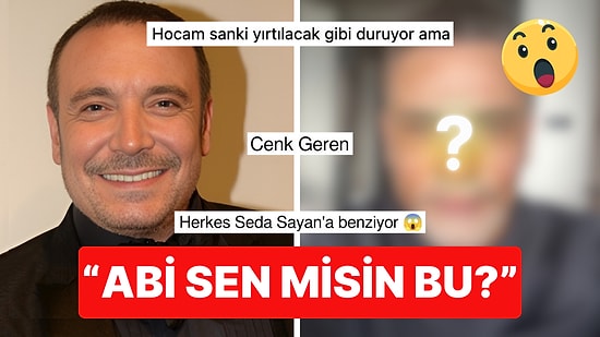 Bu Gözler Bunu da Gördü: Yüz Gerdirme Ameliyatı Olan Cenk Eren'in Son Haline İnanamayacaksınız!