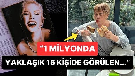 Hasta Künyesi Korkutmuştu: Minik Serçe'miz Sezen Aksu'nun Hastalığı Ortaya Çıktı!