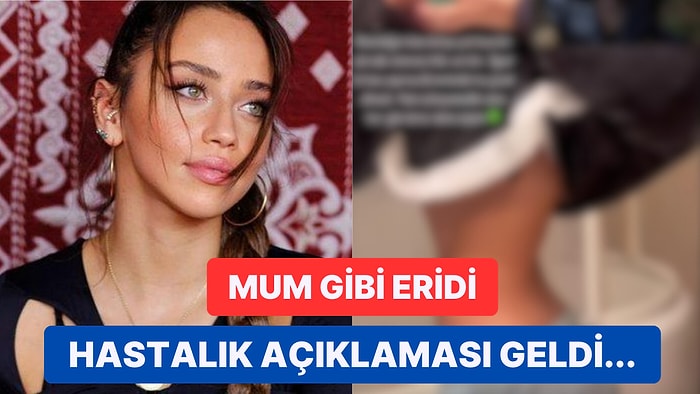 Hamdi Alkan'ın Kızı Zeynep Alkan Hastalığı Nedeniyle Verdiği Kilolarla Sevenlerini Endişelendirdi