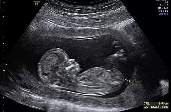 Antalya’da 23 yaşındaki bir anne doğumuna 30 gün kalan kız bebeğini 110 bin TL’ye internet üzerinden satışa koydu. İlanda bebeğin doktor kontrolleri ve ultrason fotoğraflarını da paylaşan kadın, “Acilen bebeğimi vermek istiyorum” ifadesini kullandı.