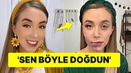 Yüzündeki Doğum Lekesinden Dolayı Zorbalandıktan Sonra 20 Ameliyat Geçiren Kadın