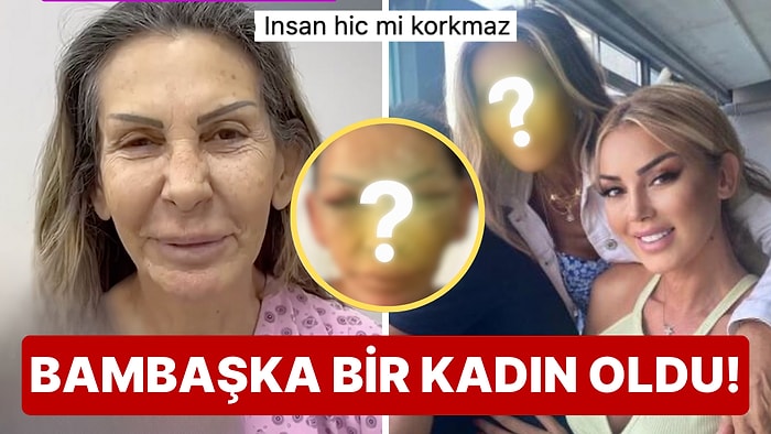 Petek Dinçöz Estetik Furyasına Annesini de Sürükledi: Annesi Gitti Başka Bir Kadın Geldi!