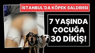 İstanbul'da Başıboş Sokak Köpeği Saldırısı: 7 Yaşında Çocuğa 30 Dikiş Atıldı