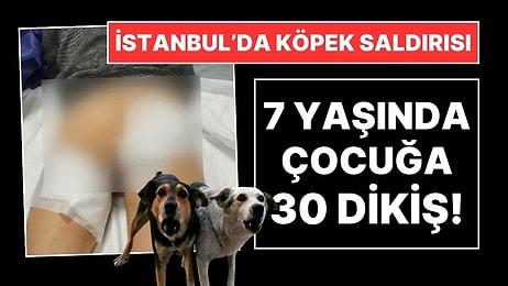İstanbul'da Başıboş Sokak Köpeği Saldırısı: 7 Yaşında Çocuğa 30 Dikiş Atıldı