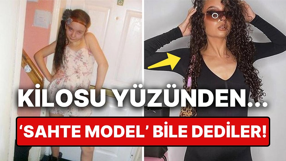 Kilosu Yüzünden Çevresi Tarafından Aşağılandığını Söyleyen Kadının Modelliğe Uzanan Hikayesi