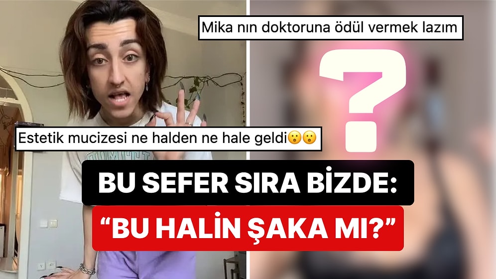 Cinsiyet Geçiş Sürecini Tamamlayan Mika Raun'un Son Hali Kelimeleri Kifayetsiz Bıraktı!