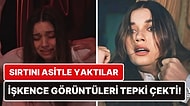 Bunlar Nasıl Sahneler? Yalı Çapkını Fragmanında Seyran'ın Sırtının Asitle Yakılmasına Tepki Yağdı!