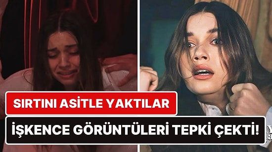 Bunlar Nasıl Sahneler? Yalı Çapkını Fragmanında Seyran'ın Sırtının Asitle Yakılmasına Tepki Yağdı!