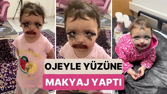 Tüm Suratını Ojeyle Boyadıktan Sonra Soluğu Hastanede Almak Zorunda Kalan Miniğin Zor Anları