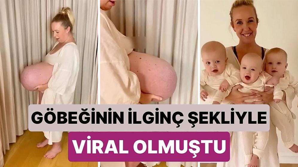 Hamileliği Sırasında Göbeğinin İlginç Şekliyle Viral Olmuştu: O Anne Üçüz Bebekleriyle Yeni Bir Video Paylaştı
