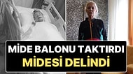 Zayıflama Arzusu Felaketi Oldu: 1 Milyon 400 Bin TL'ye Taktırdığı Mide Balonu Sonrasında Midesi Delindi