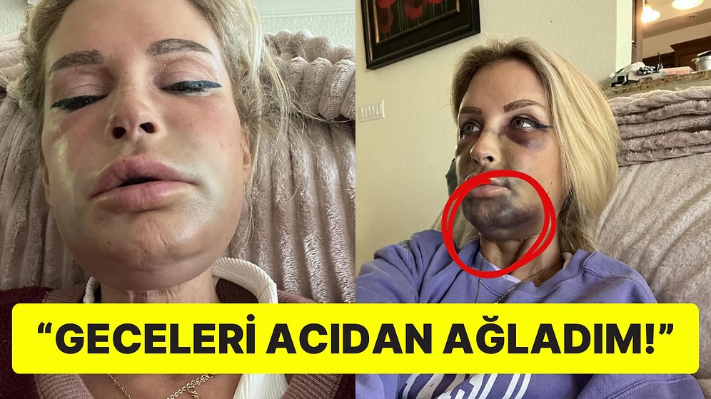 Diş Estetiği Ameliyatından Sonra Yüzü Tanınmaz Hale Gelen Kadının Akılalmaz Hikayesi