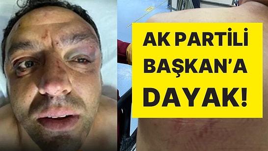 Ortalık Karıştı: AK Parti ve MHP’liler Arasında Kavga Çıktı