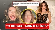 Makyajsız Doğal Halini Paylaşan Melis Sezen'in Dudak Estetiği "Doğallığın Bundan Haberi Var mı?" Dedirtti