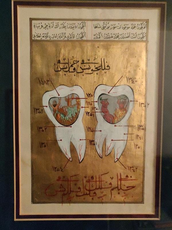Peki Osmanlı döneminde bu durum nasıldı? Fotoğrafta gördüğünüz gibi, azı dişleri içerisinde kurtlarla tasvir edilmiş.