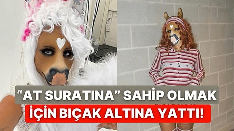 “At Suratına” Sahip Olmak İçin Yüzlerce Estetik Operasyon Geçiren Kadın Gündem Oldu