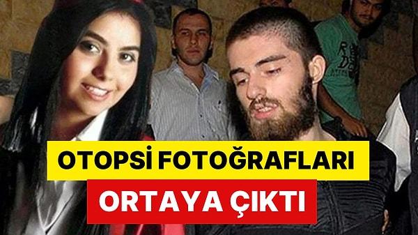 Cem Garipoğlu'nun Otopsi Fotoğrafları Ortaya Çıktı: Sağ ve Sol El Parmaklarındaki Morarmalar Dikkat Çekti