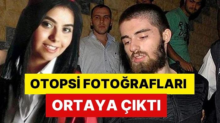 Cem Garipoğlu'nun Otopsi Fotoğrafları Ortaya Çıktı: Sağ ve Sol El Parmaklarındaki Morarmalar Dikkat Çekti