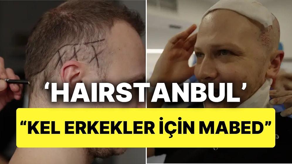 ABD'li Gazeteci İstanbul'da Saç Ektirme Sürecini Anlattı "Kel Erkekler İçin Mabed"