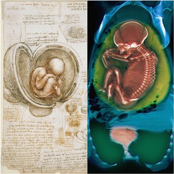 Leonardo, 500 yıl önce insan fetüsünü şaşırtıcı bir şekilde tasvir etmiş ve bir rahim içindeki konumunu doğru bir şekilde göstermiştir.