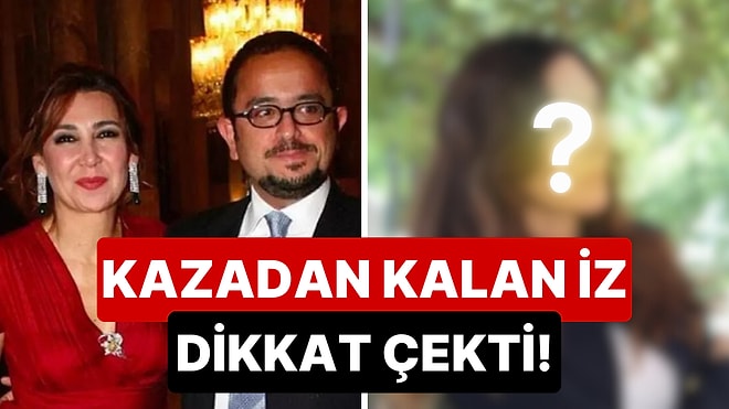 Aylar Önce Eşi Ali Sabancı ile Ölümden Dönen Vuslat Doğan Sabancı Kazadan Sonra İlk Kez Görüntülendi!