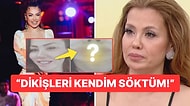 Şarkıcı Lara Dudak Estetiği Sonrası Yaşadığı Kabusu İlk Kez Anlattı: Paylaşılan Kareler Bizi Mahvetti!