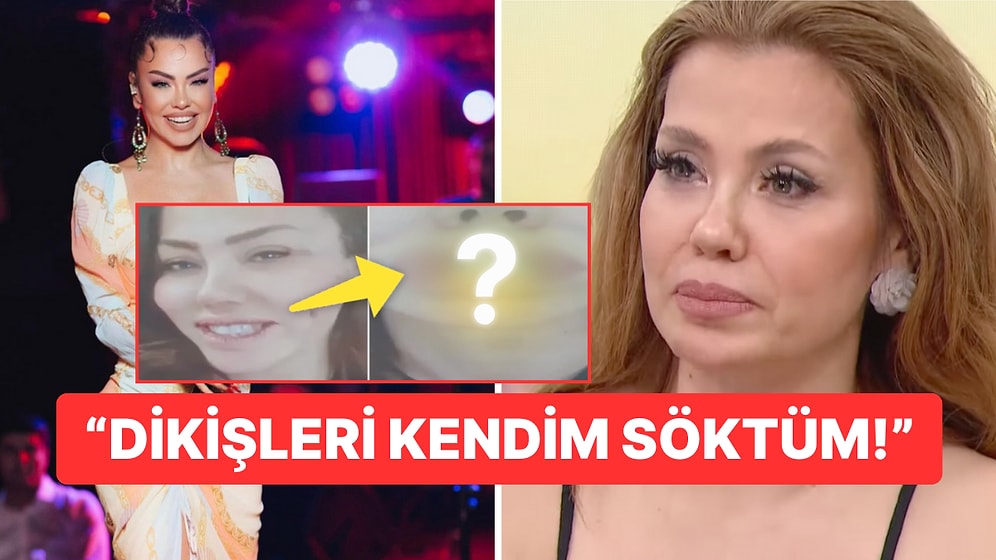 Şarkıcı Lara Dudak Estetiği Sonrası Yaşadığı Kabusu İlk Kez Anlattı: Paylaşılan Kareler Bizi Mahvetti!