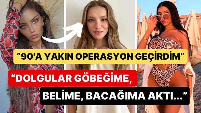 Değişimi Olay Olmuştu: Trans Birey Beren Güney Estetik İşlemleri Yüzünden Yaşadığı Sağlık Sorunlarını Anlattı