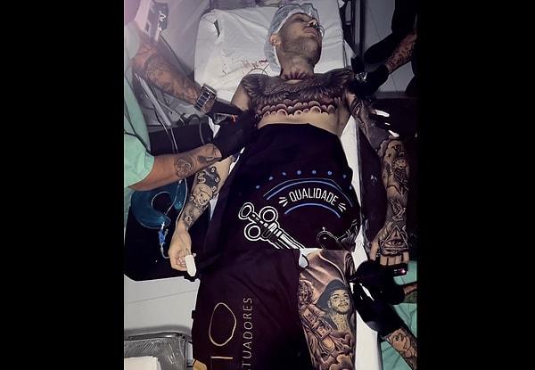 Sao Paulo'da bir dövmeci aynı anda birden fazla dövme yapabilmek için genel anestezi altında dövme yapmaya başladı.