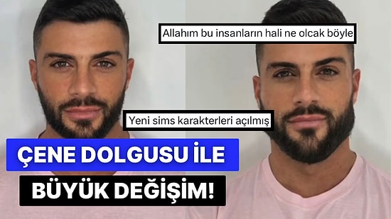 Çene Dolgusu Yaptıran Erkeklerin Önceki ve Sonraki Halleri Sosyal Medyada Viral Oldu